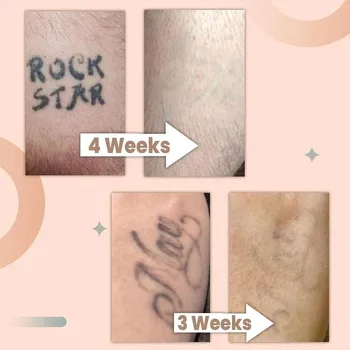 13g Trvalé Tetovanie Krém Odstránenie Bez Bolesti Odstránenie Maximálna Sila Vzor Tetovanie Čistenie Strojov Podstate make-up Starostlivosť Príslušenstvo